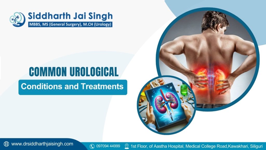 Common Urological Conditions and Treatments in Siliguri