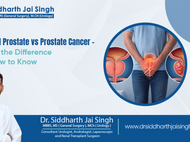 Enlarged Prostate vs Prostate Cancer -What’s the Difference and How to Know